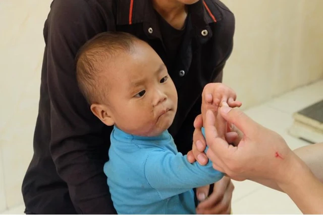 Phẫu thuật miễn phí cho trẻ em có dị tật bẩm sinh tại Bệnh viện Đa khoa tỉnh Hà Giang - Ảnh 1.